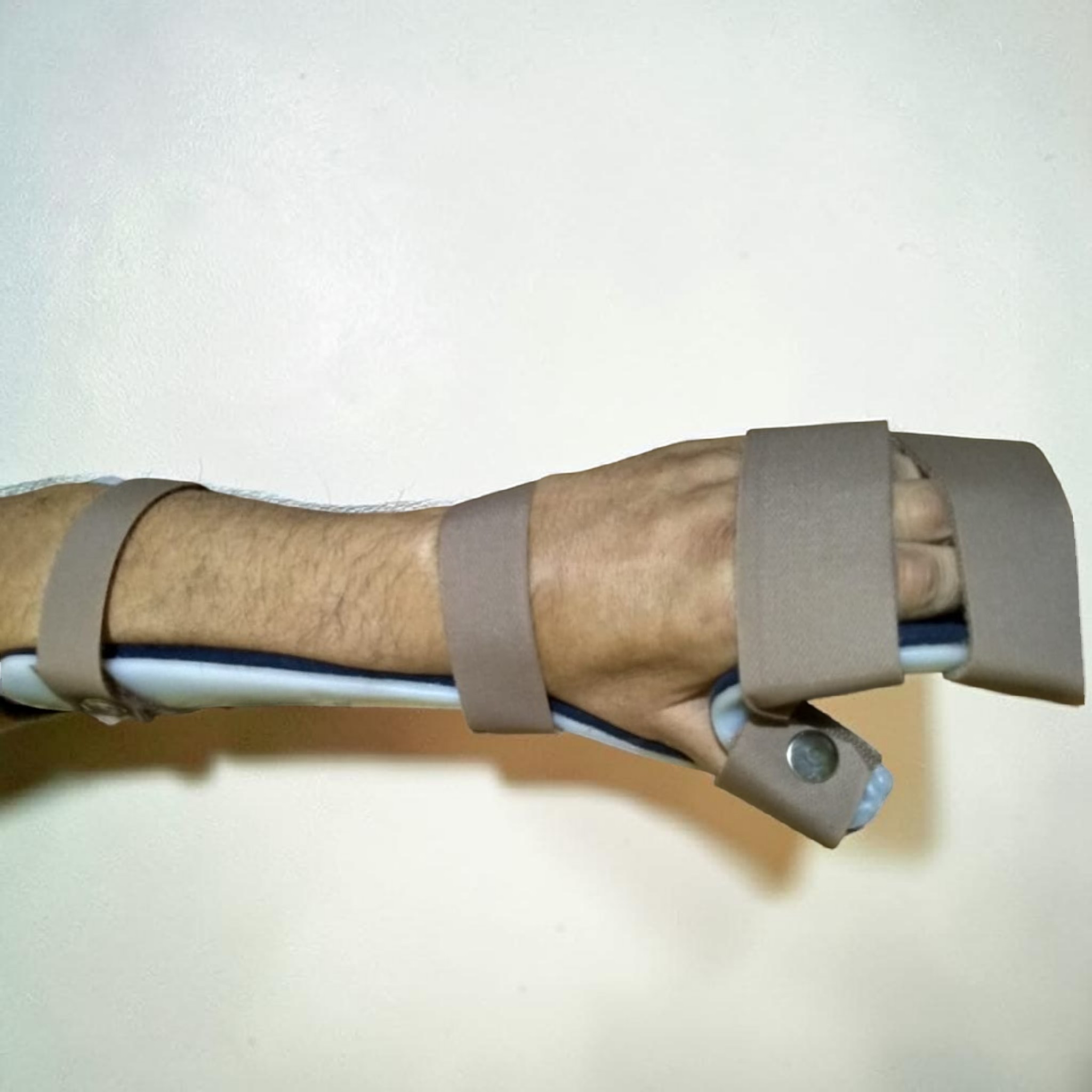 Hand Splint